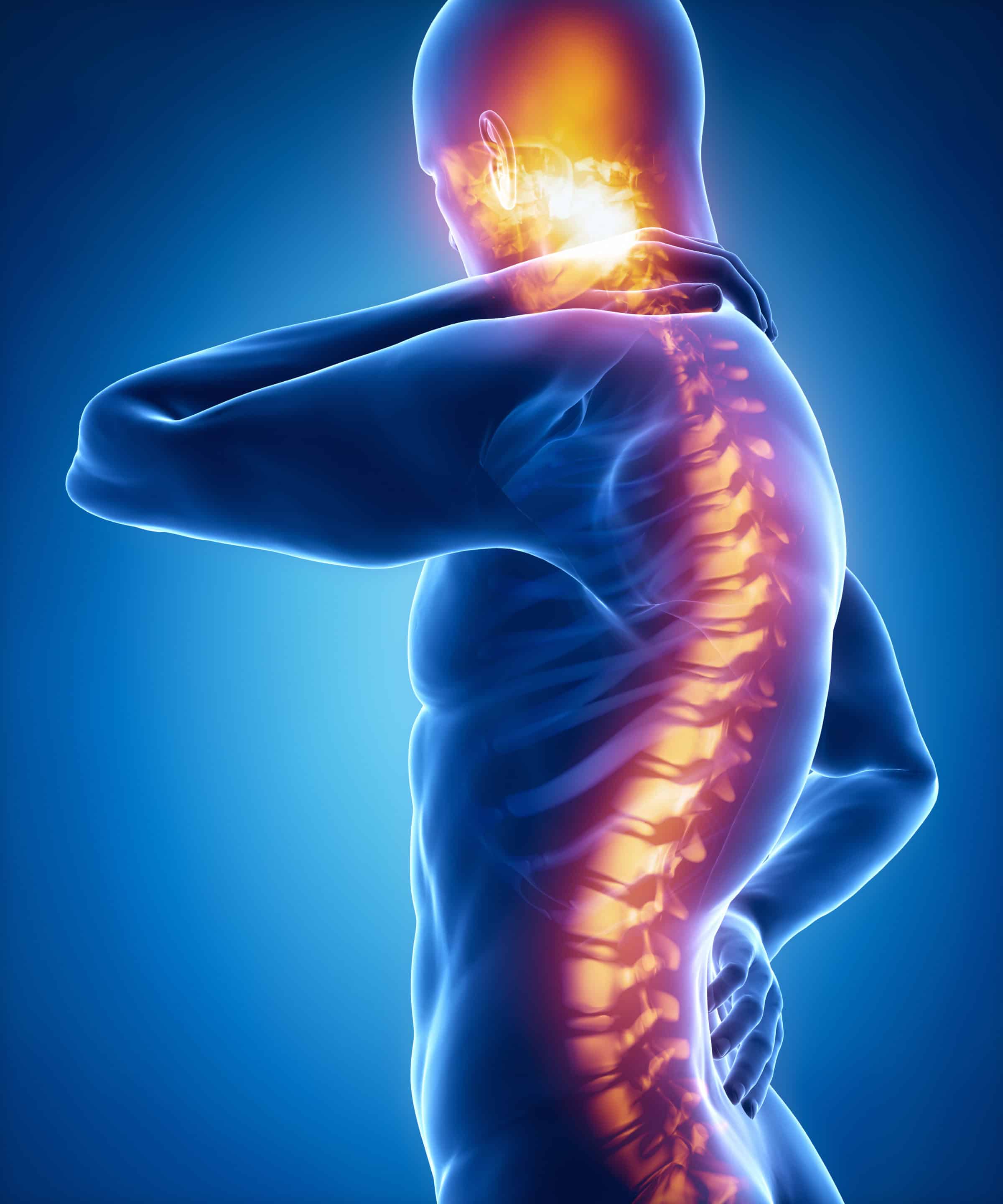 A Spinal Cord Stimulator Could be the Drug-Free Solution to Your Chronic Back  Pain : Interventional Pain and Regenerative Medicine Specialists: Pain  Management