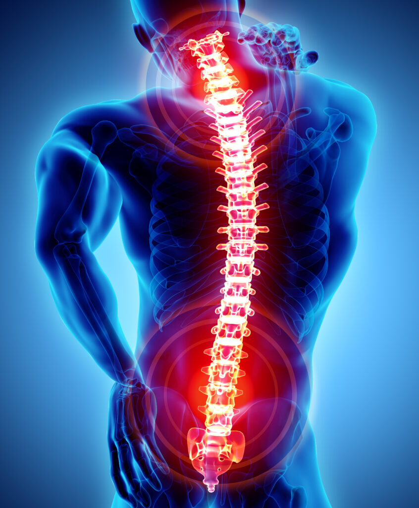 Performance Medical NJ Spine Pain Specialists